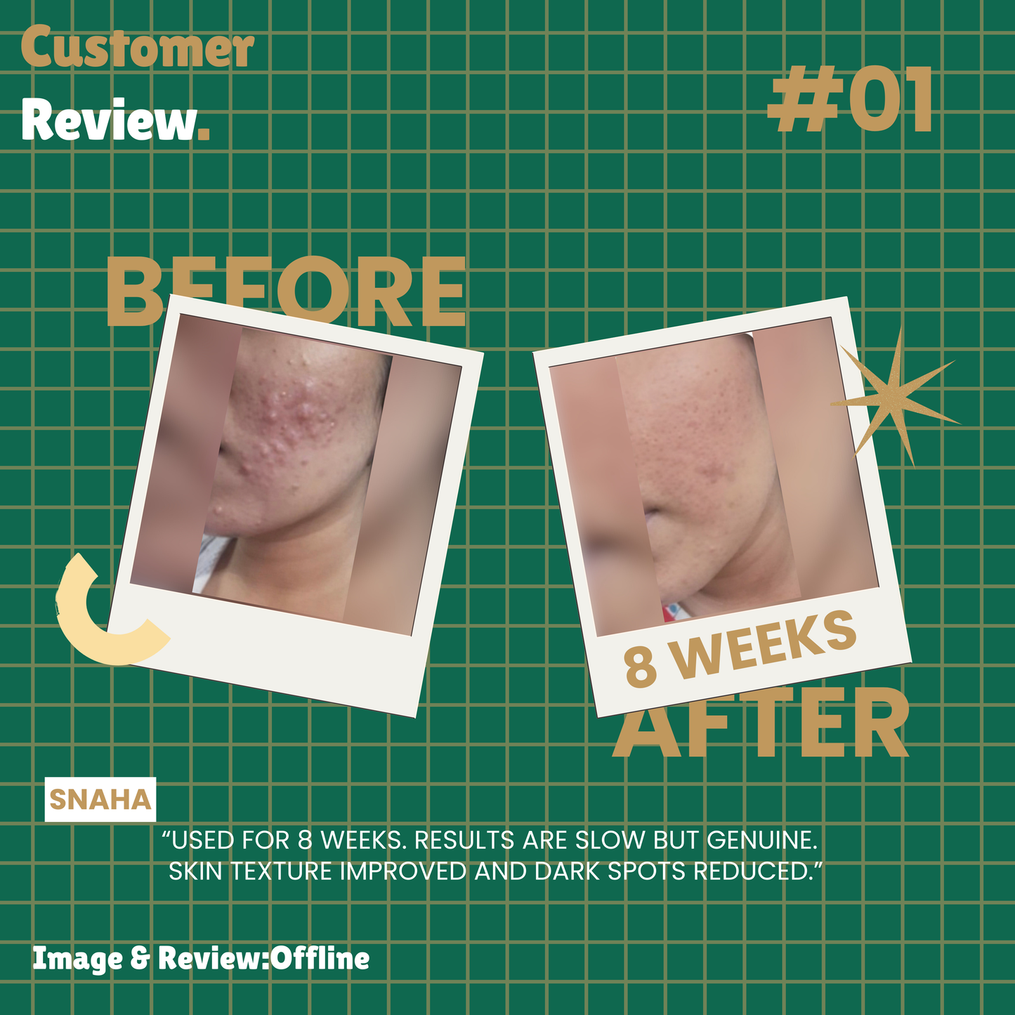 Benefits of niacinamide face serum for acne marks and oil control