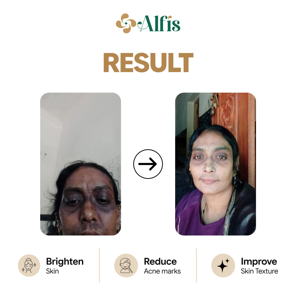 Alfis Beauty | Instant Glowing Cream | 35 G