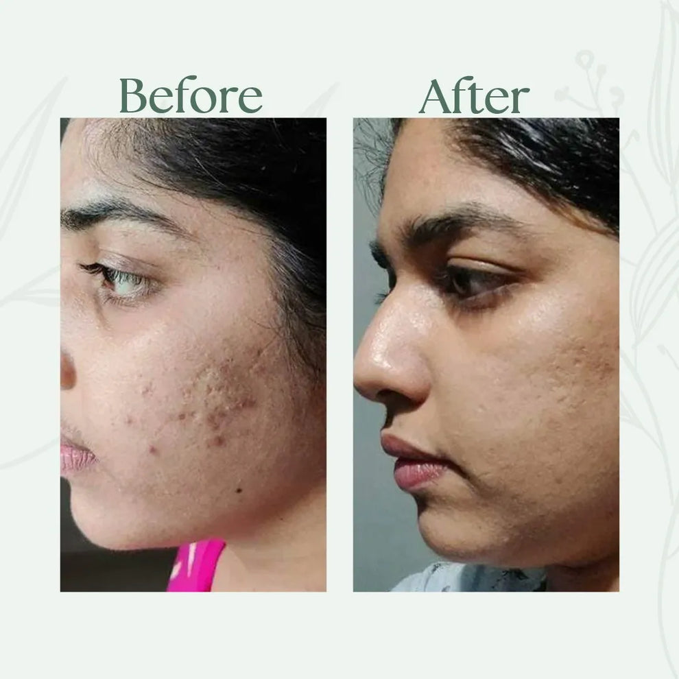 Before and after comparison of a person