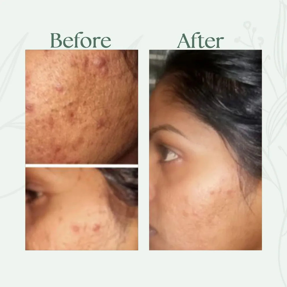 Before and after comparison of a person