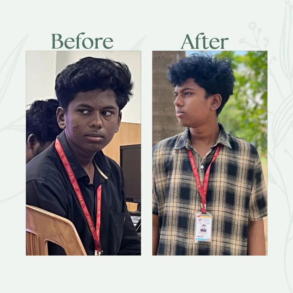 Before and after comparison of a person