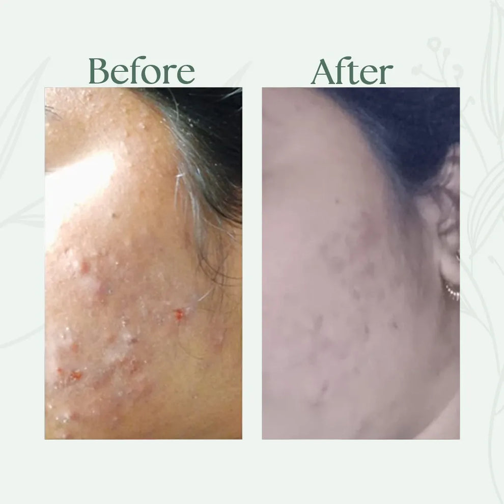 Before and after comparison of a person