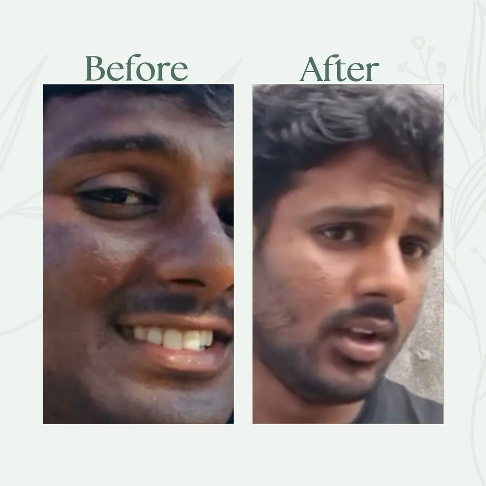 Before and after comparison of a person
